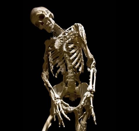 Skeleton Laying Down, Dark Realism, Skeleton Reference, Skeletal Anatomy, 2024 Illustration, Skeleton Pics, Ib Art, Art Major, Body Anatomy