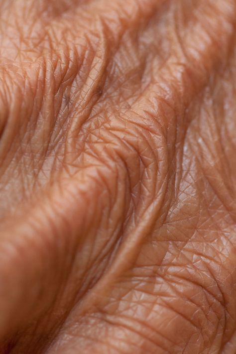 Your Flesh by Jacqueline Bernal, via Behance - close up macro shots can tell a story and give secrets of a persons identity (scars, wrinkles, blemishes etc.) they can show what the person has been through, what has formed them. Foto Macro, Losing 40 Pounds, Home Remedy For Cough, Cold Sores Remedies, Natural Sleep Remedies, Natural Cold Remedies, Texture Photography, Macro Shots, Cold Home Remedies