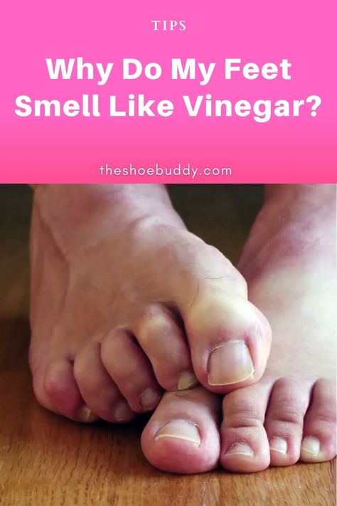 Foot Odor Remedy, Smelly Feet Remedies, Stinky Feet Remedy, Stinky Shoes, Athletes Foot, Bad Odor, Foot Health, Cool Socks, A Question