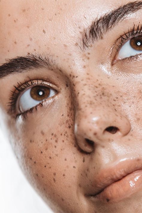 Freckle Makeup, Freckle Tattoo, Tattooed Freckles, Browning Tattoo, Freckles Makeup, Faux Freckles, Tattoo Trend, Freckle Face, Important Things To Know