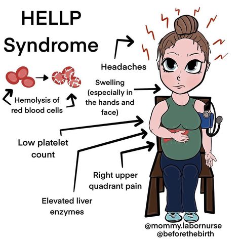 Christie | Childbirth Educator on Instagram: “A few weeks back I did a collaboration with @mommy.labornurse !😊 She’s fantastic! Go follow her if you haven’t already!🥰 Info provided by…” Hellp Syndrome, Low Platelets, Labor Nurse, Pregnancy Problems, Nursing School Studying, Nursing School Notes, Red Blood Cells, Pregnancy Birth, School Notes