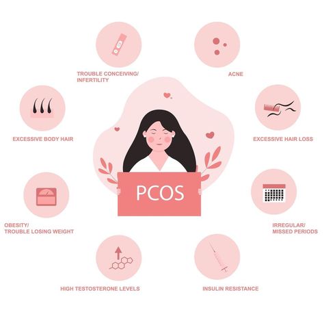 Polycystic ovary syndrome symptoms infographic High Testosterone, Polycystic Ovarian Syndrome, Healthy Lifestyle Habits, Testosterone Levels, Women's Health, Sociology, Short Story, Vector Art, Art Drawings