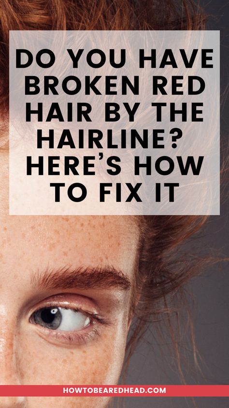 Usually, broken hairs are caused by heat damage, chemical damage, pregnancy/childbirth, or stress on the hair. If you have broken red hair pieces, here’s what you can do to fix them. Red Hair Pieces, Make Your Hair Grow Faster, Hair Grow Faster, Grow Hair Faster, Healthy Routine, Heat Damage, Grow Hair, What You Can Do, Hair Hacks