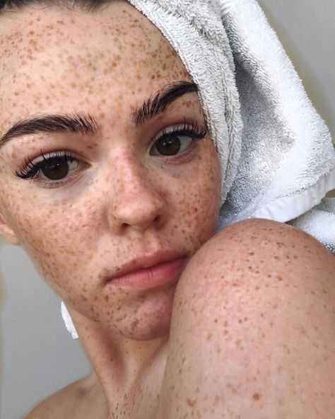 @broganquigley on Instagram: “Freckles 🧖🏽‍♀️” #summer #freckles #natural Freckles Summer, Freckles Natural, Summer Freckles, People With Freckles, Beautiful Freckles, Freckles Girl, Freckle Face, Feeling Insecure, My Vibe