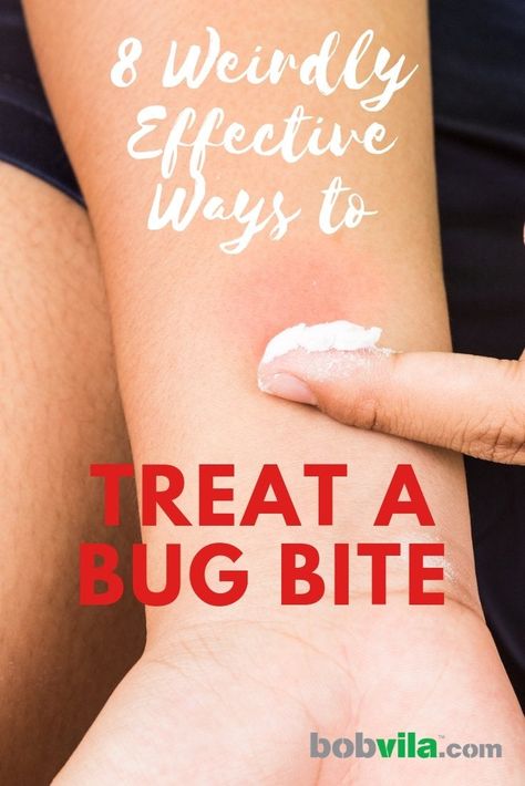 How To Help Bug Bites, How To Treat Mosquito Bits, Itchy Bug Bite Remedy, Infected Bug Bite, Treating Spider Bites, Bed Bug Bites Remedies, Bug Bite Swelling, Treating Mosquito Bites, Bug Bite Itch Relief