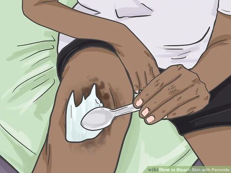 How To Bleach Skin, Bleach Skin, Dark Patches On Skin, Bleaching Your Skin, Dark Inner Thighs, Face Mask Cream, Skin Lightening Diy, Body Bleaching, Peroxide Uses