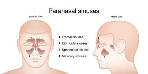 Sinus Remedies, Inflammation Remedies, Paranasal Sinuses, Relieve Sinus Pressure, Lymph Drainage Massage, Maxillary Sinus, Nasal Obstruction, Tooth Infection, Sinus Problems