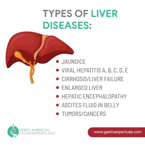 Types of Liver Diseases:    #liver #tumor #health #hepatits #AbuDhabi Liver Diseases Post, Enlarged Liver, Ecg Interpretation, Liver Failure, Beautiful Flowers Images, Stomach Pain, Weight Reduction, Digestive System, Health Problems