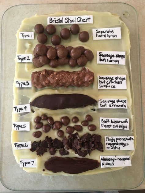 Bristol Stool Chart Cake Stool Chart Health, Bristol Stool Chart Cake, Glucose Molecule, Chocolate Chemical Structure, Stool Chart, Bristol Stool, Bristol Stool Chart, Shabby Chic Table And Chairs, Perfect Chocolate Chip Cookies