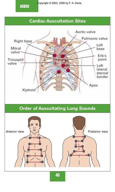 auscultation of lungs sounds - Google Search Auscultating Lung Sounds, Respiratory Therapist Student, Wound Care Nursing, Physical Therapy School, Lung Sounds, Nursing Assessment, Nursing School Essential, Nurse Study Notes, Nursing Mnemonics