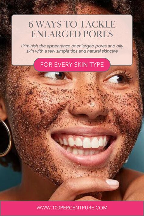 Smaller Pores How To Get, Pore Extraction, Big Pores, Textured Skin, Beauty App, Large Pores, Enlarged Pores, Get Over It, Getting Old