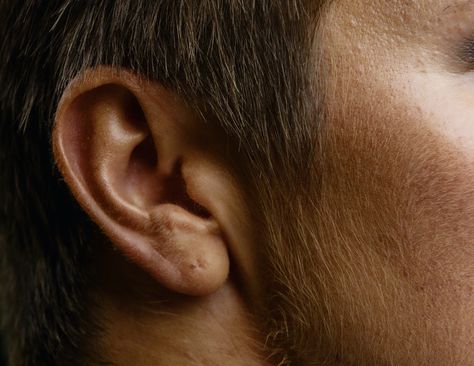 This study shows a major cause of hearing loss in older people Itchy Ears, Hearing Problems, Ear Canal, Makeup Salon, Hearing Loss, Cute Stories, Hearing Aids, Old People, Health Problems