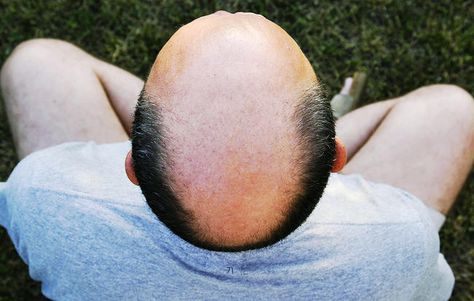 Follow these tips for a clean shave every time. 3 Easy Ways to Shave Your Bald Head Shaving Your Head, Going Bald, Low Libido, Clean Shave, Increase Heart Rate, Bald Man, Bald Hair, Regrow Hair, New Hair Growth