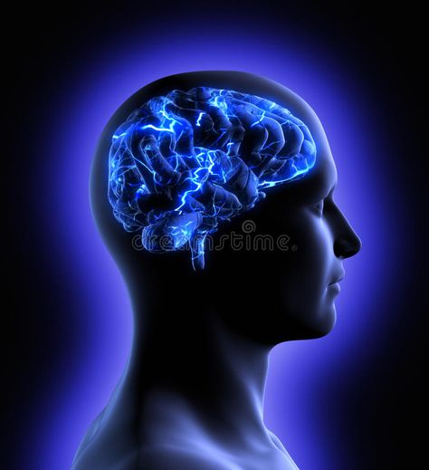 Brain Activity. Conceptual image of a man from side profile showing brain and br , #AFF, #image, #man, #Conceptual, #Brain, #Activity #ad Brain Neurons, Brain Structure, Magnetic Resonance, Improve Cognitive Function, Brain Power, Kundalini Yoga, Brain Waves, Human Brain, Brain Function