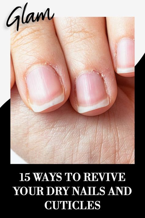 Peeling Cuticles, Cuticle Repair, Nail Remedies, Peeling Nails, Dry Cuticles, Nail Soak, Weak Nails, Nail Repair, Nail Care Tips