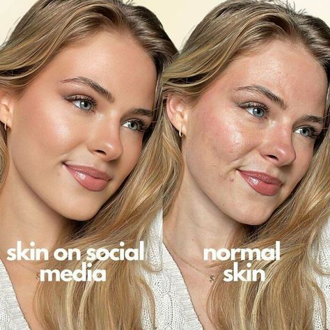 Filter Is Not Real Life Face Mapping Acne, Eyeliner Techniques, Real Skin, Celebrity Skin, Swag Girl Style, Healthy Skin Tips, Face Acne, Perfect Relationship, Pretty Skin