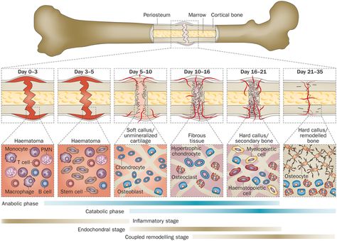 Tissue Biology, Fracture Healing, Nerdy Nurse, Bone Healing, Nurse Practitioner School, Medicine Studies, Sports Therapy, Biomedical Science, Musculoskeletal System