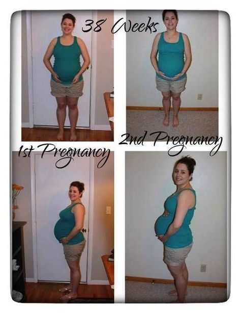 Brewers Diet Pregnancy, Brewers Diet, Pregnancy Diet Recipes, Brewer Diet, Pregnancy Diet, Breastfeeding Foods, Pregnant Diet, Future Children, Pre Pregnancy