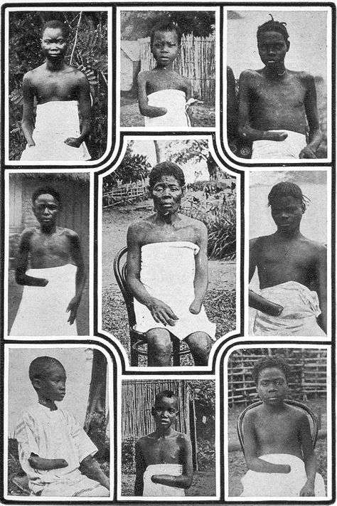 Congo Free State, King Leopold, Sumber Daya Alam, Belgian Congo, Historia Universal, Free State, African Diaspora, African History, African American History