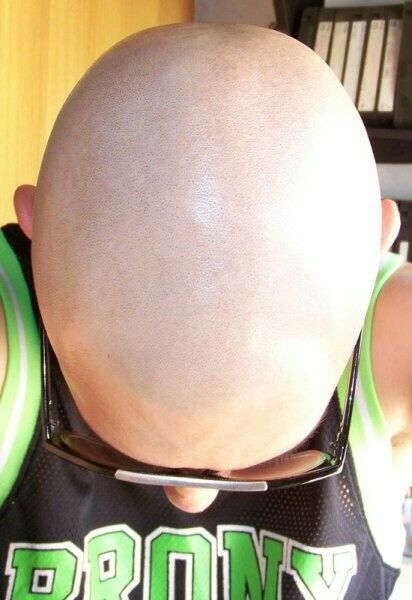 Shiny shaved head. Bald Head Man, Bald Hairstyles For Women, Bald Head Women, Girls With Shaved Heads, Bald Men Style, Bald Look, Shaved Hair Cuts, Half Shaved Hair, Bald Girl