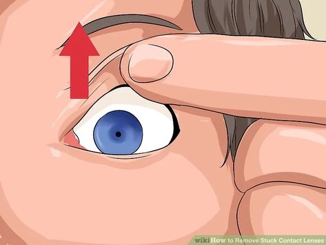 3 Ways to Remove Stuck Contact Lenses - wikiHow Contact Lenses Tips, Dark Underarms, Eye Sight Improvement, Health Vitamins, Colored Contacts, Stick It Out, Contact Lenses, Eye Care, Lenses