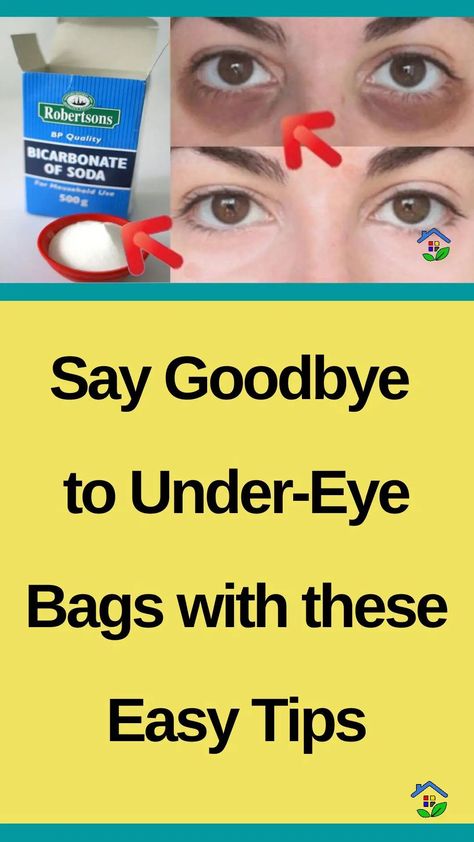 Dark circles under your eyes make you look tired and worn out. We already know that You have tried so many remedies in vain, and for that, we are here to help. Each remedy has its undesirable side effects, but have you ever thought about baking soda? This time, we have chosen a natural remedy […] Baking Soda Under Eyes Dark Circles, Baking Soda For Eye Bags, Dark Under Eyes Remedy, How To Get Rid Of Dark Circles Under Eye Fast, Under Eye Puffiness Remedies, Depuff Under Eyes, Remove Bags Under Eyes, Dark Circles Under The Eyes Remedies, Baking Soda Under Eyes