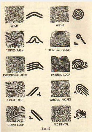 types of finger prints Types Of Fingerprints, Forensic Anthropology, Detective Aesthetic, Forensic Psychology, Forensic Scientist, Forensic Science, Forensic, Science Experiments, Anthropology