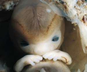 Human Embryo, Endocannabinoid System, Oldest Human, Electron Microscope, Charles Darwin, Anatomy And Physiology, The Human Body, Microbiology, Human Anatomy