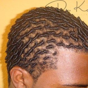 Starting Dreads With Short Hair, Male Starter Locs, Starter Dreads, Tiny Locs, Start Locs, Starting Locs, Men Twist, Men Locs, Dreads Short Hair