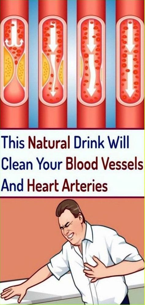 Heart Arteries, Clogged Arteries, Coconut Health Benefits, Benefits Of Coconut Oil, Natural Drinks, Health Advice, Blood Vessels, Healthy Tips, Way Of Life