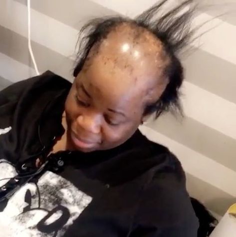 A woman with alopecia went to a salon in Brooklyn, New York, to get her hair done and left with the most amazing makeover. See it here! Benefit Cosmetics, Alopecia Hair Growth, Bald Haircut, Alopecia Hairstyles, Black Women Short Hairstyles, Going Bald, Make Up Videos, Hair Transformation, Grey Hair