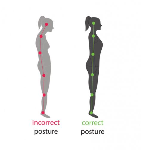 How to Look Picture-Perfect in Every Photo (8 Easy Steps) — The Beauty Block Good Personality, Gerd Symptoms, Standing Posture, Correct Posture, Perfect Posture, Uneven Skin Texture, Health Lessons, Health Design, Poor Posture