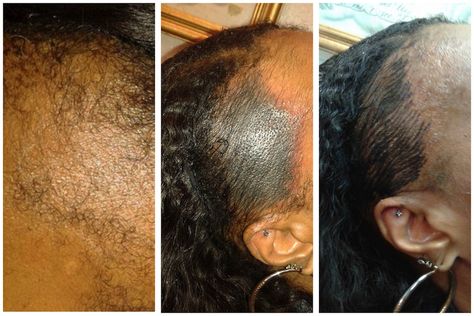 Lost Your Edges? - Would You Ever Consider An Edge Tattoo? - https://blackhairinformation.com/general-articles/opinion/lost-edges-ever-consider-edge-tattoo/ Tattoo Edges Hair, Hair Line Tattoo, Edge Tattoo, Blow My Mind, Alopecia Hairstyles, Los Angeles Tattoo, Edges Hair, Hair Line, Its All Good