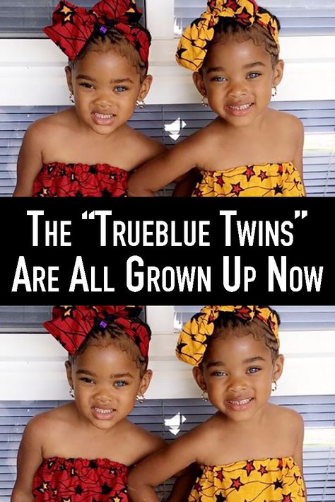 Trueblue Twins, Ken Hair, Black Twin Babies, Conjoined Twins, Baby Shoes Diy, Twin Photos, Twin Outfits, Most Beautiful Eyes, Identical Twins