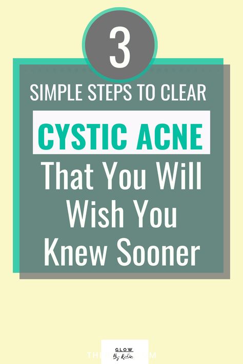 Foods For Cystic Acne, Heal Pimples Fast, Skin Care Routine For Cystic Acne, Natural Remedies For Cystic Acne, How To Get Rid Of Cystic Acne Overnight, Get Rid Of Cystic Acne Overnight, Cystic Acne Skin Care Routine, How To Clear Up Acne Fast, How To Treat Cystic Acne