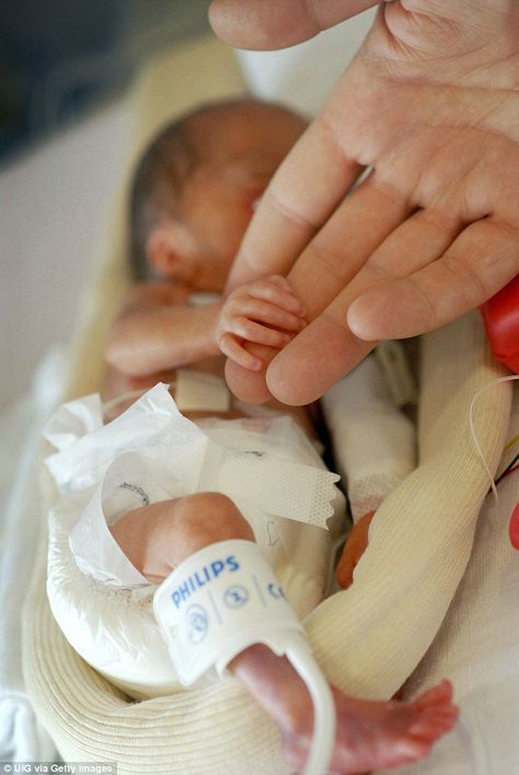 The hidden toll of being a premature baby: Modern medicine helped them defy the odds. But as the first generation of ultra-premature babies grow up, their struggles are far from over...  Read more: http://www.dailymail.co.uk/femail/article-3414833/Hidden-toll-premature-baby-Modern-medicine-helped-defy-odds-generation-ultra-premature-babies-grow-struggles-far-over. Healthy Baby Boy, Miracle Baby, Prenatal Care, Premature Baby, First Generation, Doll Painting, Marriage And Family, Pregnancy Week By Week, Having A Baby