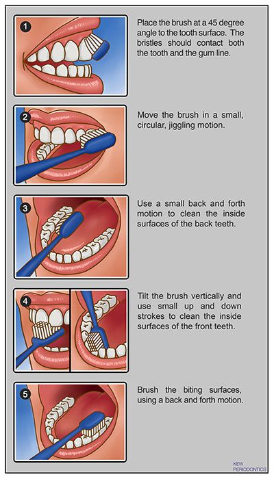 How To Brush Your Teeth, Dental Post, Dental Pictures, Dental Assistant Study, Dental Photos, Dental Social Media, Dental Assisting, Dental Posts, Dental Posters