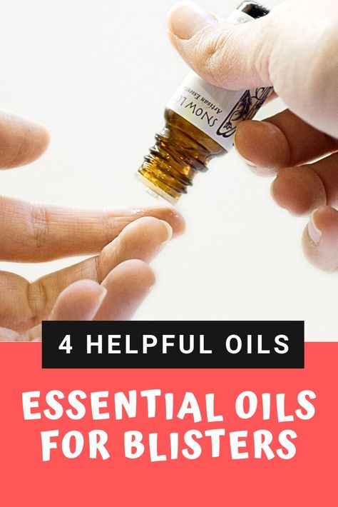 Learn how to naturally treat blisters with this essential oil remedy. Treat blisters on your feet, toes, hands, and lips #blisters #essentialoils #doterra #youngliving #naturalremedy Essential Oils For Blisters, How To Treat Blisters, Heal Blisters, Blister Remedies, Blister On Lip, How To Heal Blisters, Blood Blister, Fever Blister, Diy Essential Oil Recipes