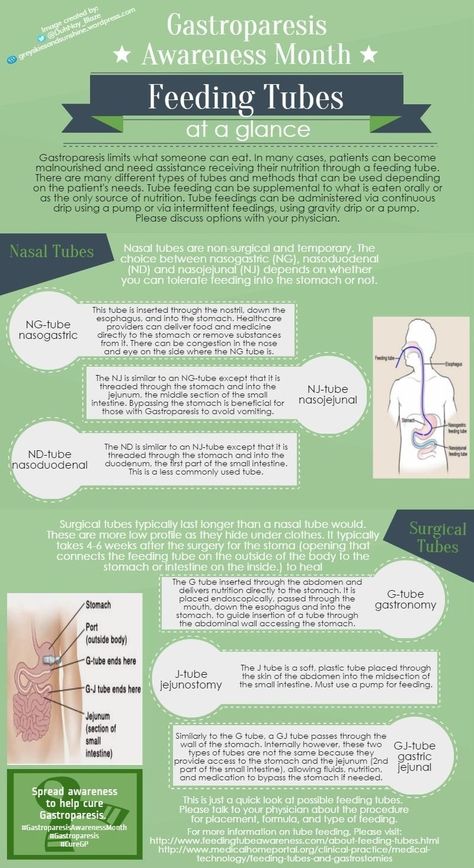 Gastroparesis ‪#‎GastroparesisAwarenessMonth‬ Day 8 is a glance at ‪#‎FeedingTubes‬. To be honest this post was hard to condense as each tube could use it's own post, not to mention the different formulas and methods of feeding. This is a very condensed look at types of tubes that can be used for getting ‪#‎nutrition‬, medication and hydration when oral methods are no longer enough. Enteral Feeding, Heal Cavities, Mc Donald, Nursing School Notes, Shiatsu Massage, Nursing Tips, Feeding Tube, The Dentist, Nursing Study