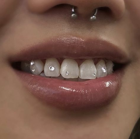 Teeth Gems Retainer, Tooth Gems Simple, Strass Teeth, Simple Tooth Gems Ideas, Cross Tooth Gem, Bottom Tooth Gem, Teeth Crystals, Piercing Dental, Tooth Gem Ideas