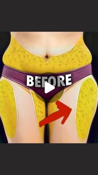 Outer Thigh Fat, Thigh Fat Workout, Outer Thigh, Remove Belly Fat, All Body Workout, Quick Workout Routine, Basic Workout, Thigh Fat, Fat Removal