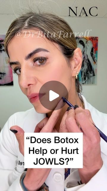 Dr. Bita Zadeh Farrell on Instagram: "Neuromodulators like Botox can help or hurt the appearance of jowls. Botox in the masseter muscle at the back of jawline can shrink this area, lessening the support and making the area in front sag more, thus worsening the jowls.  Botox in the platysma and DAO muscles will lessen their  down pull and help lift the midface, improving the appearance of jowls.   #jawline #jowls #botox #botoxtraining #drbitafarrell #naturalaestheticscenter" Botox For Jowls, Botox Jawline Before And After, Masseter Botox Before And After, Masseter Muscle, Aesthetic Nursing, Botox Injection Sites, Botox Training, Botox Before And After, Tove Lo