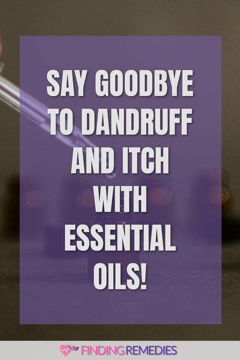 Say goodbye to dandruff and itch with essential oils! Dry Scalp Essential Oil Remedy, Essential Oil Recipe For Dandruff, Itchy Scalp Remedy Diy, Oils For Itchy Scalp, Dandruff Remedy Diy, Essential Oils For Dandruff, Itchy Scalp Remedy, Severe Dandruff, Natural Dandruff Remedy