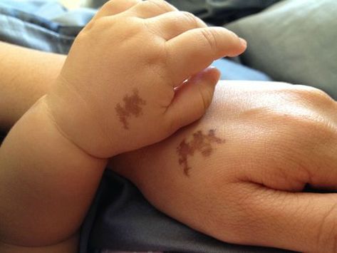 Baby's birthmark, mom's tattoo. - how original, and adorable! Birthmark Tattoo, Tattoos Infinity, Tattoos Geometric, Hand Tattoo, Mom Tattoos, Body Modifications, Skin Art, Piercing Tattoo