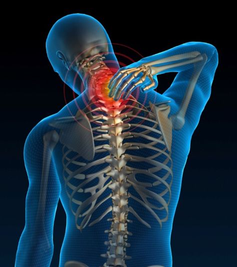 Cervical sprain: An injury to the ligament (sprain) or muscle (strain) of neck. Most commonly cause by whiplash. One of the most common muscoeskeletal problem. Severe Neck Pain, Hand Reflexology, Health And Wellness Center, Neck Injury, Restless Leg Syndrome, Neck And Shoulder Pain, Muscle Strain, Low Back Pain, Shoulder Pain