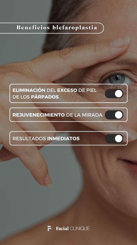 ¡Logra una mirada rejuvenecida y cautivadora con la blefaroplastia! 😍  La blefaroplastia, también conocida como cirugía de párpados, es el camino hacia unos ojos revitalizados.  Al eliminar cuidadosamente el exceso de piel y reajustar los tejidos podrás lucir más joven y radiante con tu mirada. 🤩  📍Clínicas en Barcelona, Bilbao, Castellón, Mallorca, Santander, Valencia  #parpados #arrugas #bolsas #parpadoscaidos #facial #beauty #tratamiento #cirugiaesteticafacial #antesydespues #rejuvenecer Plastic Surgery Marketing, Daniel Garcia, Plastic Surgery, Surgery, Facial, Medical, Skin, Beauty