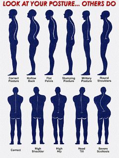 Mr. E's Singing Page Posture Fix, Fix Your Posture, Posture Exercises, Yoga Beginners, Spine Health, Bad Posture, Body Posture, Chiropractic Care, Better Posture