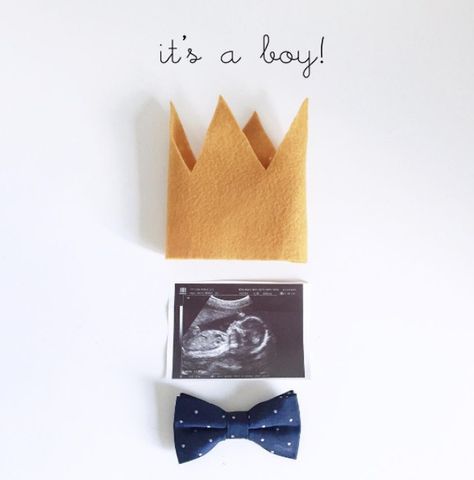 Gender Announcement Ideas Creative Gender Reveals, It's A Boy Announcement, Gender Reveal Photos, Vogue Kids, Idee Babyshower, Baby News, Foto Baby, Foto Tips, Baby Tips