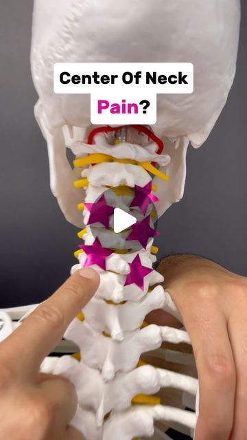 Dr. Joe Damiani - TMJ, Head & Neck Specialist on Instagram: "Comment the word ‘NECK’ on this post if you need help getting rid of Neck Pain for good.

Do you experience neck pain that persists on the center of the neck? This can happen if you are unable to maintain your cervical spine in an upright position.

One key muscle group that pulls the neck into an upright posture are the Deep Neck Flexors!  They attach to the FRONT of the cervical vertebrae (AKA Neck) and facilitate stabilization.

In this video I show a test that can determine if these muscles are weak on you.  If the test is positive AKA the muscles are weak.  I have also included an exercise to begin building strength.  Test yourself and start getting stronger!

#neckpain #neckpainrelief #neckpaintreatment #pinchednerve #cervi Pulled Muscle In Neck, Knots In Neck Muscle, Neck Decompression, Neck Muscle Exercises, Cervical Pain Exercises, Neck Muscle Anatomy, Upright Posture, Muscles Of The Neck, Cervical Pain