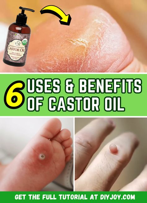 Castor Oil Skin, Castor Oil Benefits Skin, Castor Oil Pack Benefits, Benefits Of Castor Oil, Castrol Oil, Castor Oil Uses, Castor Oil For Skin, Castor Oil Benefits, Castor Oil Packs